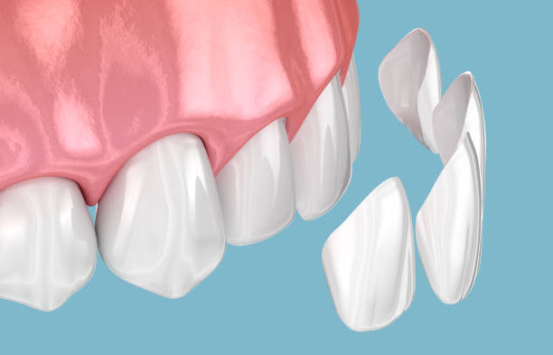 Smile Design at Dr. Dhanshree's Dental Clinic
