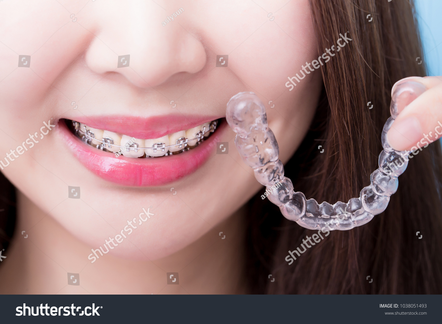 Braces at Dr. Dhanshree's Dental Clinic